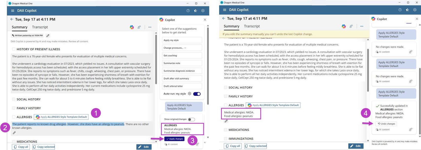 Copilot menu with suggested template and Apply changes button highlighted on the left, and the Undo changes button highlighted on the right.