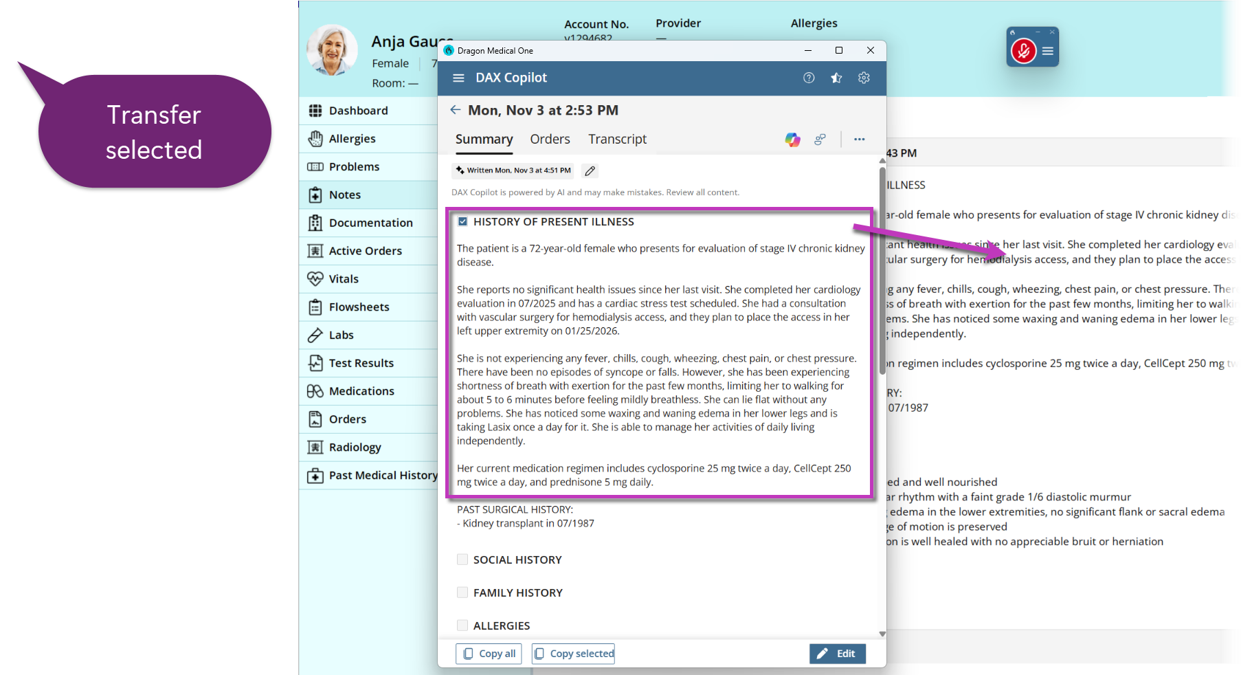 A sample DAX Copilot window with the HPI section highlighted and an arrow pointing to the EHR where the text in the DAX Copilot window has been copied. A speech bubble at the left says transfer selected.