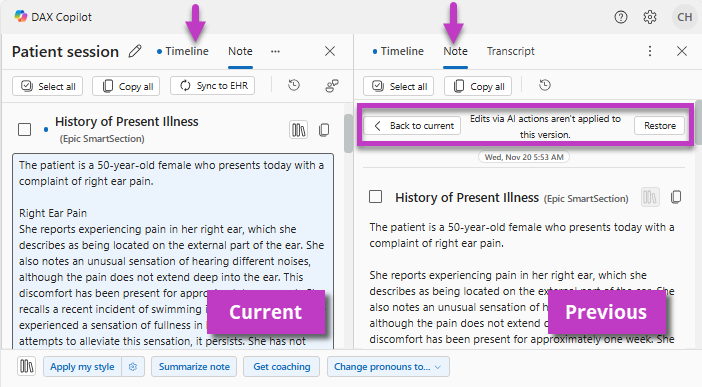 Image highlights Split view displaying two note versions.