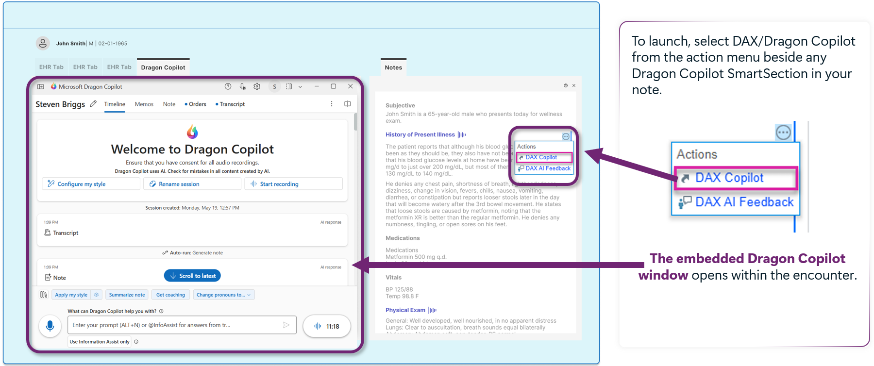 Start Dragon Copilot vanuit het menu > Acties DAX Copilot
