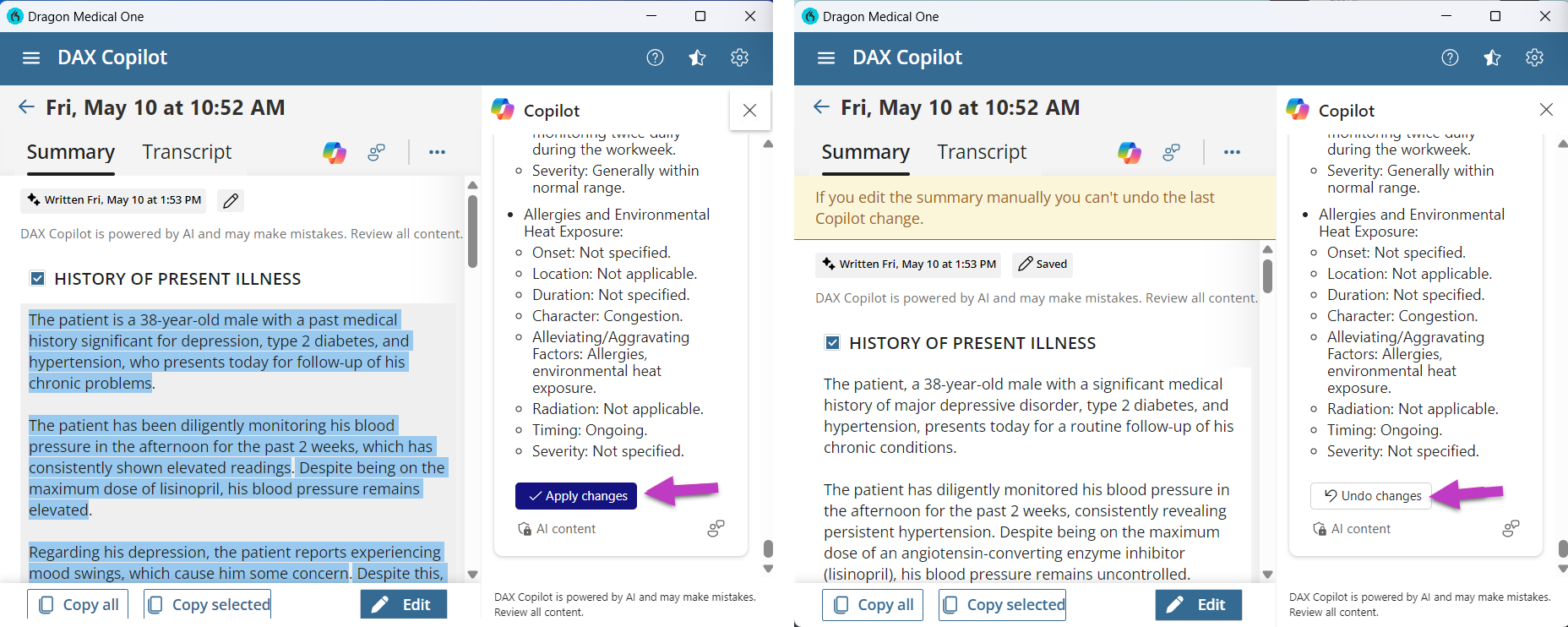 Image shows summary page with AI capabilities created by Copilot with Apply changes button and Undo changes button highlighted with arrow