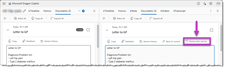 Side-by-side view of two document versions highlighting the Restore this version button.