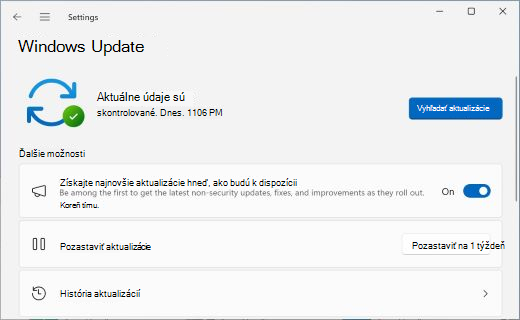 Zobrazuje obrazovku Windows Update s prepínačom, ktorý vám umožňuje vybrať, či chcete získať najnovšie aktualizácie hneď, ako budú k dispozícii.