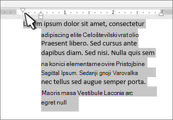Oznaka visečega zamika