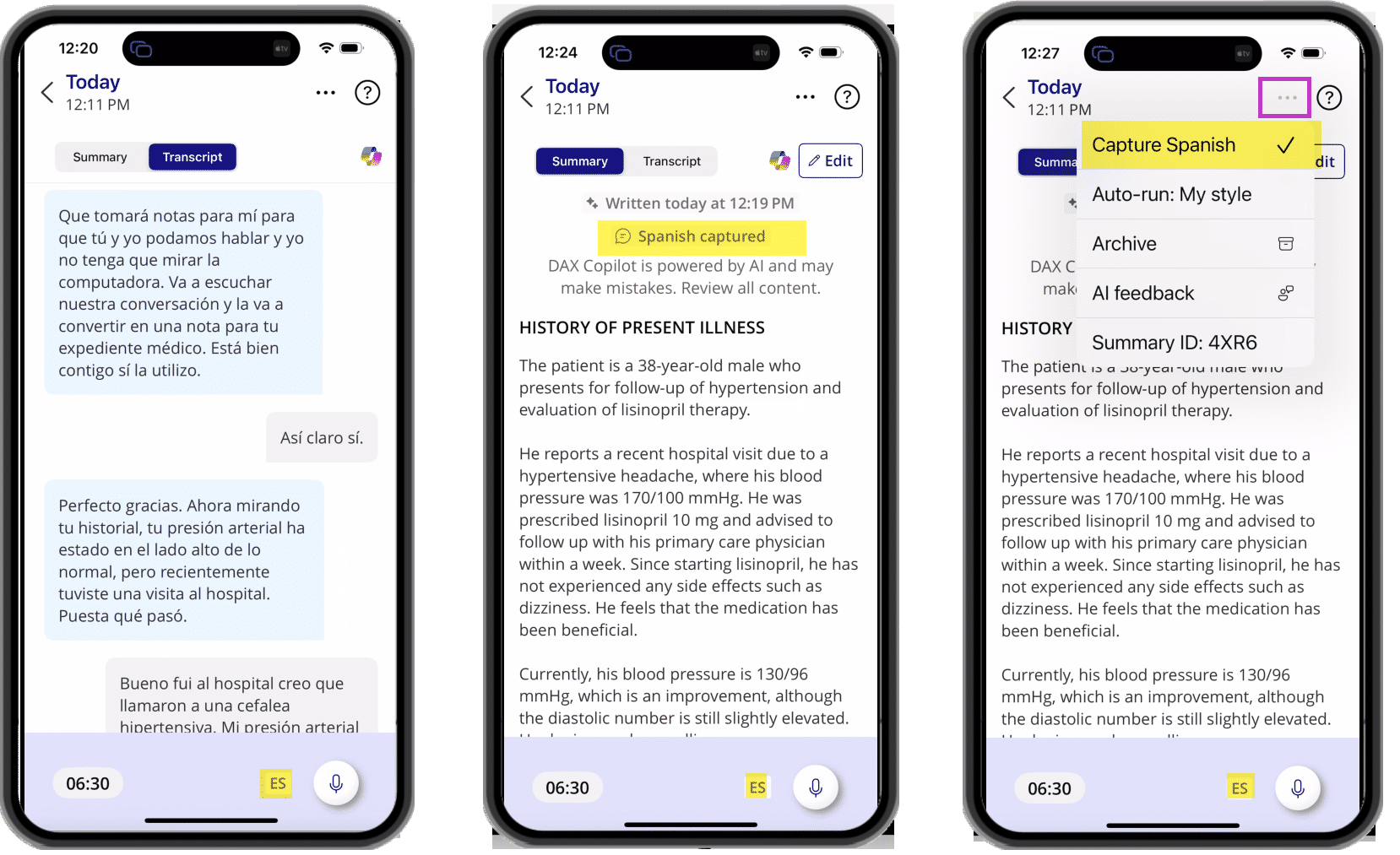 DAX Copilot mobile app with transcript tab, summary tab, and ellipses menu all with Spanish capture designations highlighted in yellow.